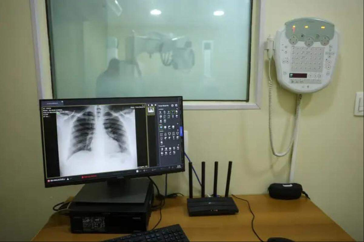 Raio-X: equipamentos contemplarão quatro unidades de saúde da cidade